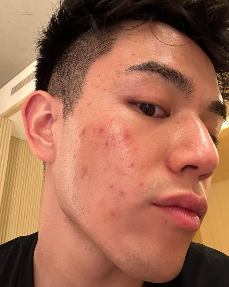 Nick in the BS Era (Before Sxnse)